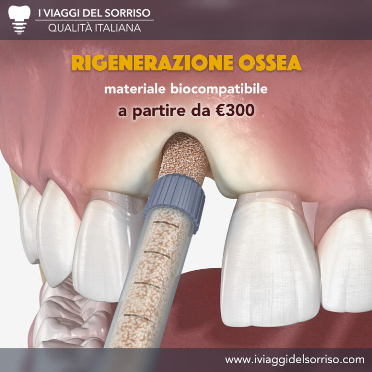 Risparmia oltre il 50% sui costi rispetto alle stesse cure dentali fatte in Italia